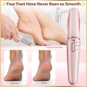 Exfoliant électrique des callosités- Rechargeable